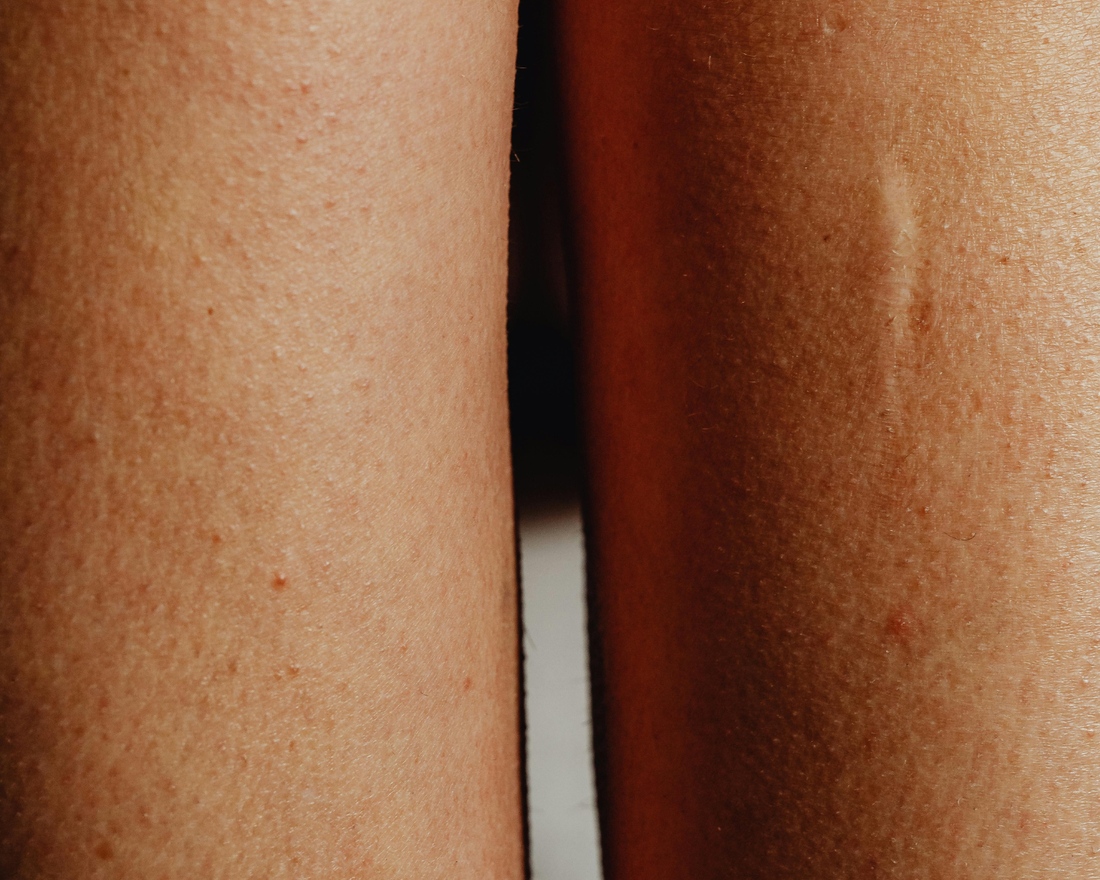 Geriausias nudistų kempingas Kroatijoje: kodėl „Valalta“ Rovinyje neturi lygių?